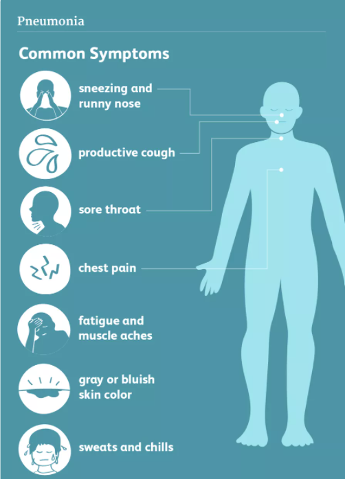 Symptoms of pneumonia